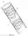 Fig. 16 - Minimal surface area contact device for holding plaque to blood vessel wall