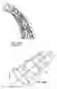 Fig. 18 - Minimal surface area contact device for holding plaque to blood vessel wall