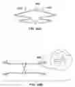 Fig. 22 - Minimal surface area contact device for holding plaque to blood vessel wall