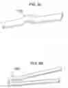 Fig. 26 - Minimal surface area contact device for holding plaque to blood vessel wall