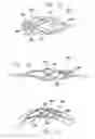 Fig. 14 - INTRAVASCULAR DEVICE AND SYSTEM