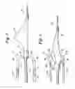 Fig. 03 - Rolled tip recovery catheter