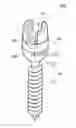 Fig. 01 - Spine fixation device