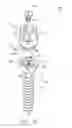 Fig. 02 - Spine fixation device