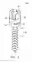 Fig. 04 - Spine fixation device