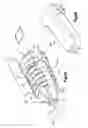 Fig. 05 - Facet interference screw
