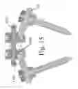 Fig. 16 - Spinal stabilization systems and methods of use