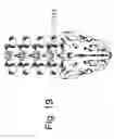 Fig. 20 - Spinal stabilization systems and methods of use