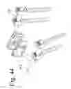 Fig. 45 - Spinal stabilization systems and methods of use