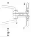 Fig. 54 - Spinal stabilization systems and methods of use