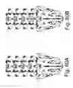 Fig. 60 - Spinal stabilization systems and methods of use