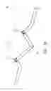Fig. 05 - FLEXIBLE SPINAL FIXATION DEVICE AND ROD THEREOF
