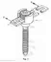 Fig. 02 - Spinal fixation system