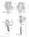 Fig. 32 - Spinal fixation system