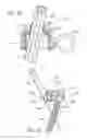 Fig. 33 - Spinal fixation system