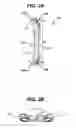 Fig. 04 - Spinal fixation plate