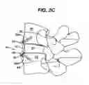 Fig. 05 - Spinal fixation plate