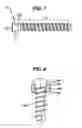Fig. 10 - Spinal fixation plate