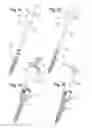 Fig. 05 - Instruments for use with a bone anchor with plug member
