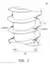 Fig. 03 - Implant Structure
