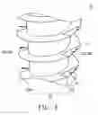Fig. 04 - Implant Structure