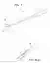 Fig. 03 - Arthroscopic tibial sizer