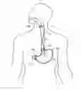 Fig. 01 - Method and Apparatus for Treatment of the Gastrointestinal Tract