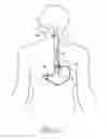 Fig. 02 - Method and Apparatus for Treatment of the Gastrointestinal Tract