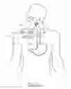 Fig. 03 - Method and Apparatus for Treatment of the Gastrointestinal Tract