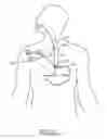 Fig. 06 - Method and Apparatus for Treatment of the Gastrointestinal Tract