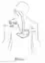 Fig. 07 - Method and Apparatus for Treatment of the Gastrointestinal Tract