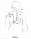 Fig. 08 - Method and Apparatus for Treatment of the Gastrointestinal Tract