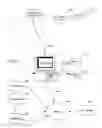 Fig. 03 - Responsive electrical stimulation for movement disorders