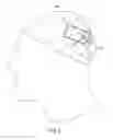Fig. 04 - Responsive electrical stimulation for movement disorders