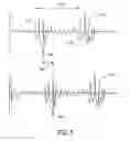 Fig. 07 - Responsive electrical stimulation for movement disorders