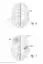 Fig. 04 - Methods and apparatus for effectuating a lasting change in a neural-function of a patient
