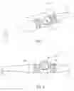 Fig. 02 - IMPLANTABLE ANCHOR WITH LOCKING CAM