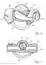 Fig. 07 - IMPLANTABLE ANCHOR WITH LOCKING CAM