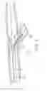 Fig. 08 - Bifurcated stent and delivery system