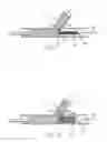Fig. 10 - Bifurcated stent and delivery system