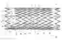 Fig. 01 - Highly flexible stent and method of manufacture