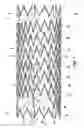 Fig. 02 - Highly flexible stent and method of manufacture