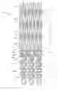 Fig. 01 - Ostium support for treating vascular bifurcations