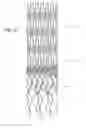 Fig. 05 - Ostium support for treating vascular bifurcations