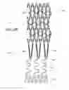 Fig. 15 - Ostium support for treating vascular bifurcations