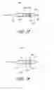 Fig. 22 - Ostium support for treating vascular bifurcations