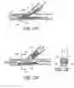 Fig. 27 - Ostium support for treating vascular bifurcations