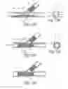 Fig. 28 - Ostium support for treating vascular bifurcations