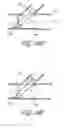Fig. 32 - Ostium support for treating vascular bifurcations