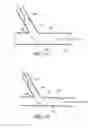 Fig. 35 - Ostium support for treating vascular bifurcations